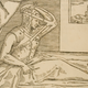 Illustration for article titled Nose jobs have been around since the 16th century